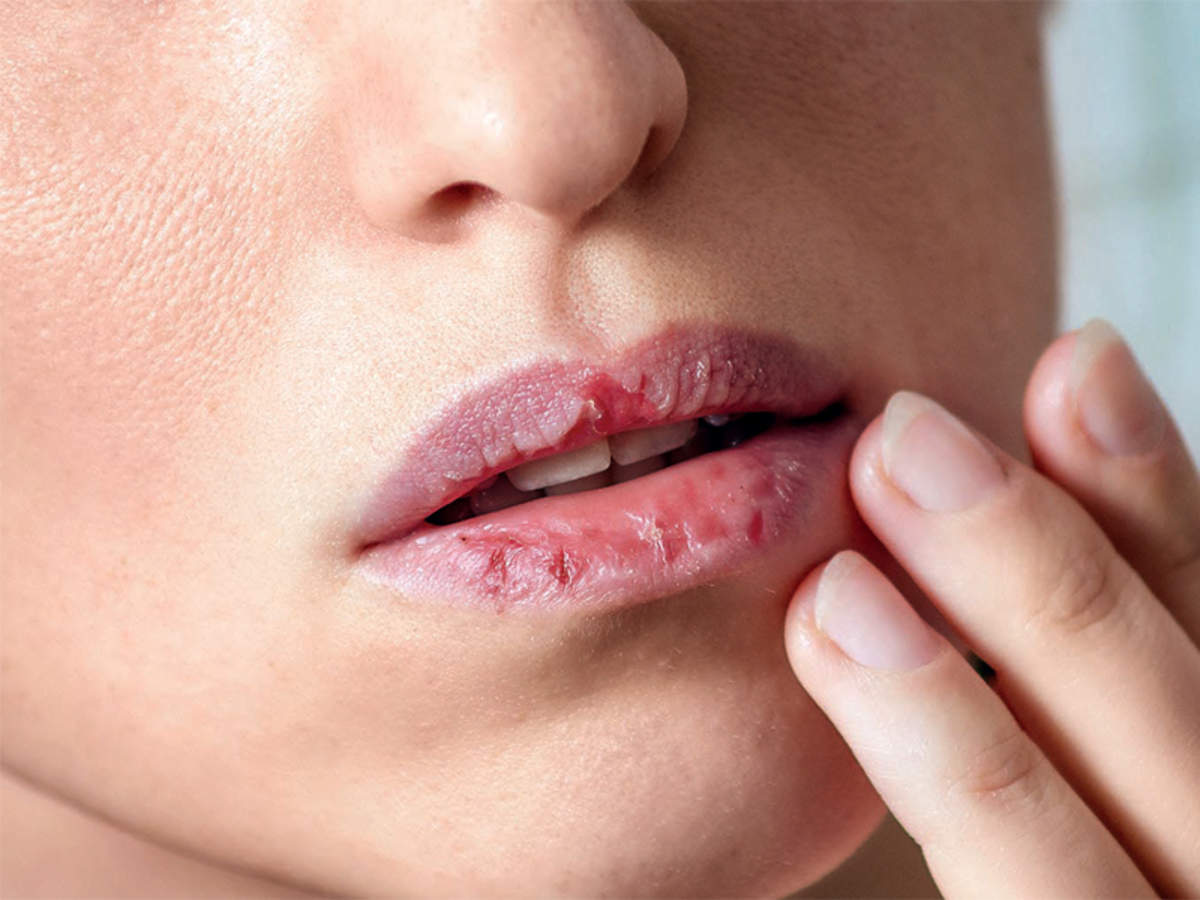 입술과 혀가 건강에 대해 알려주는 것-동의보감