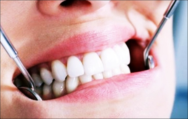 종근당 이모튼 캡슐 가격 부작용