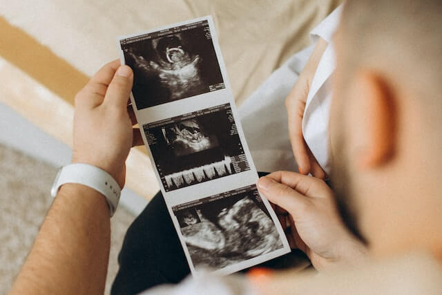태아 사진을 보고 있는 아빠