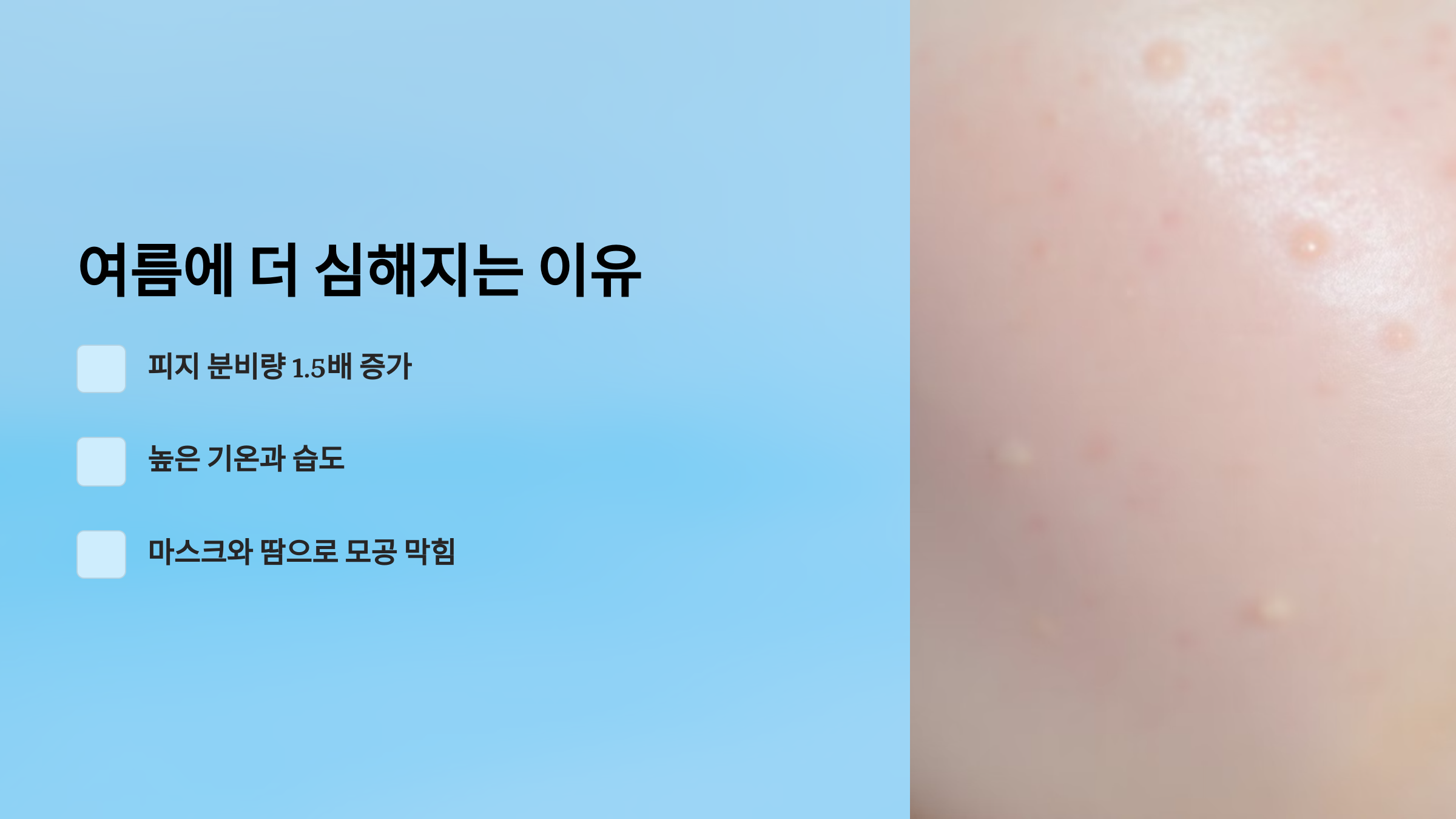 여름에 더 심해지는 이유