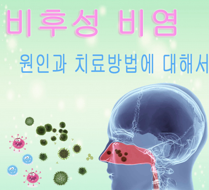 비후성비염의 원인, 증상, 치료 방법