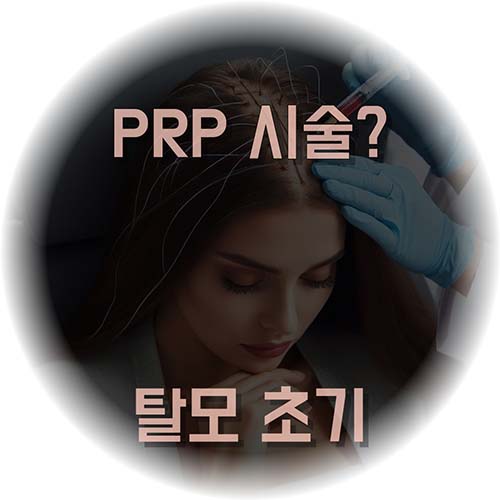 탈모-PRP-시술