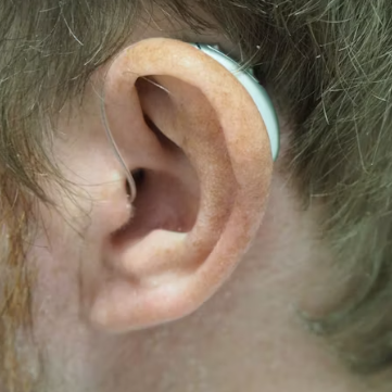 이명 치료 방법 증상 원인