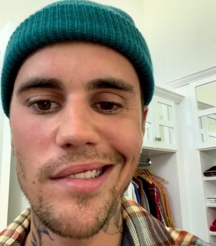 안면마비 전조증상 6가지 및 안면마비 발병 원인과 고치는법 (+ 자주묻는질문) 