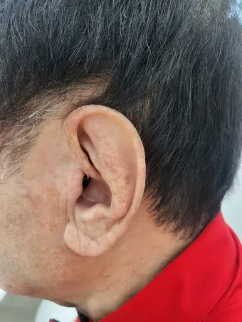 보청기 선택 귀걸이형 귓속형 배터리 교체 유지관리_8