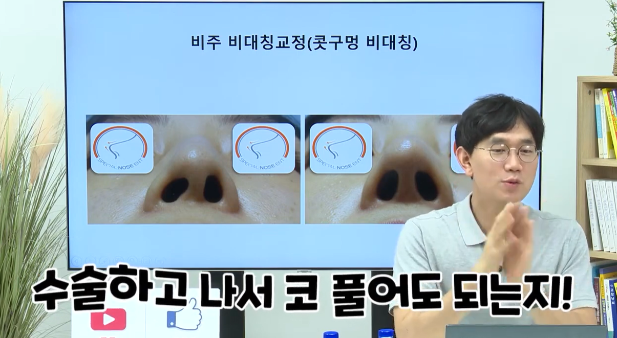 수술 하고 나서 코 풀어도 됨