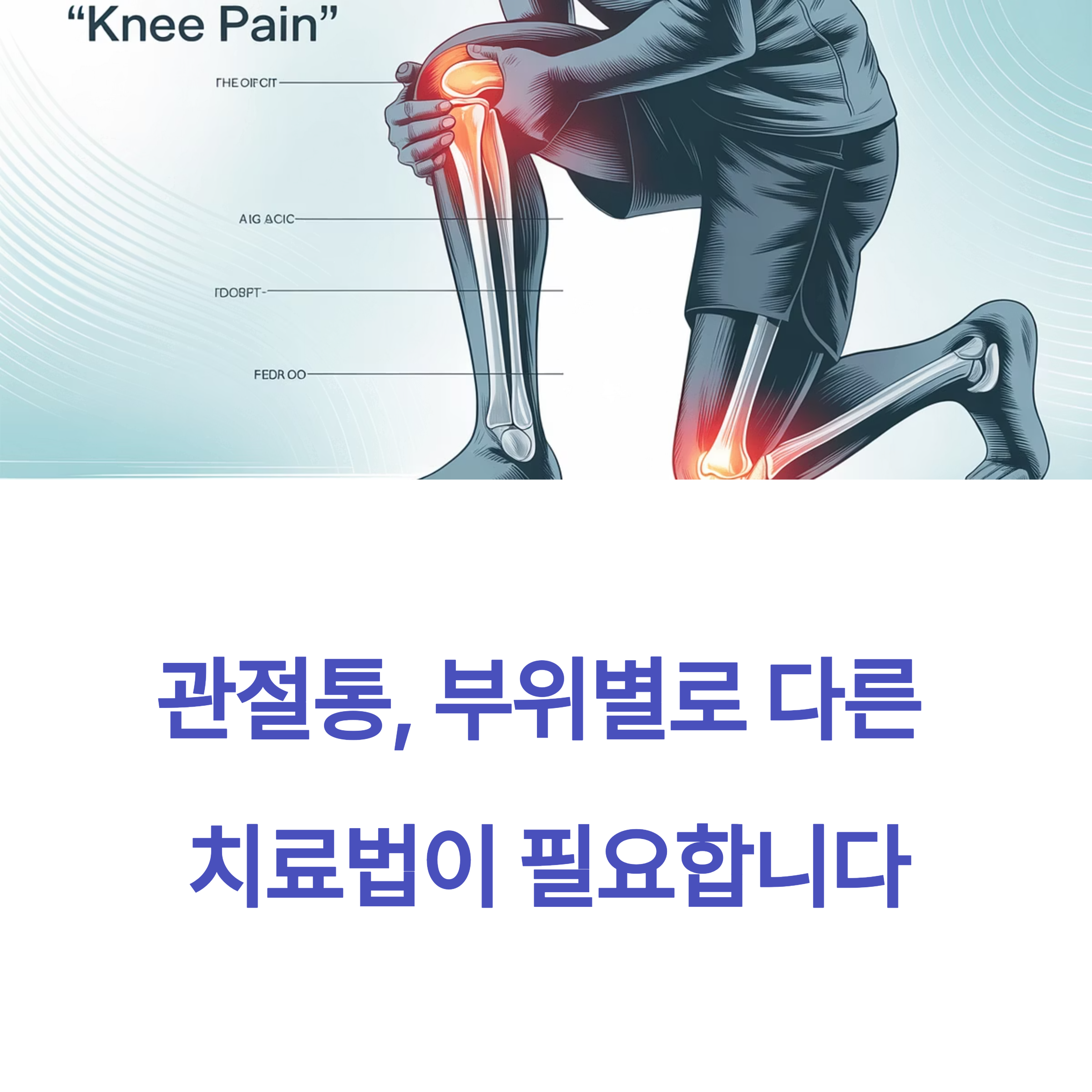 관절통 치료법 완전 정복