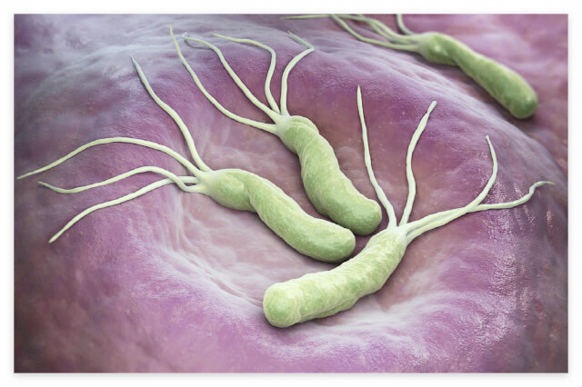 헬리코박터균 증상