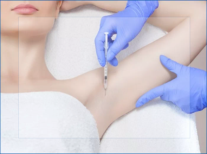 겨드랑이 보톡스