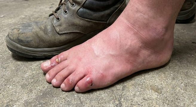 발볼좁은-은잔화