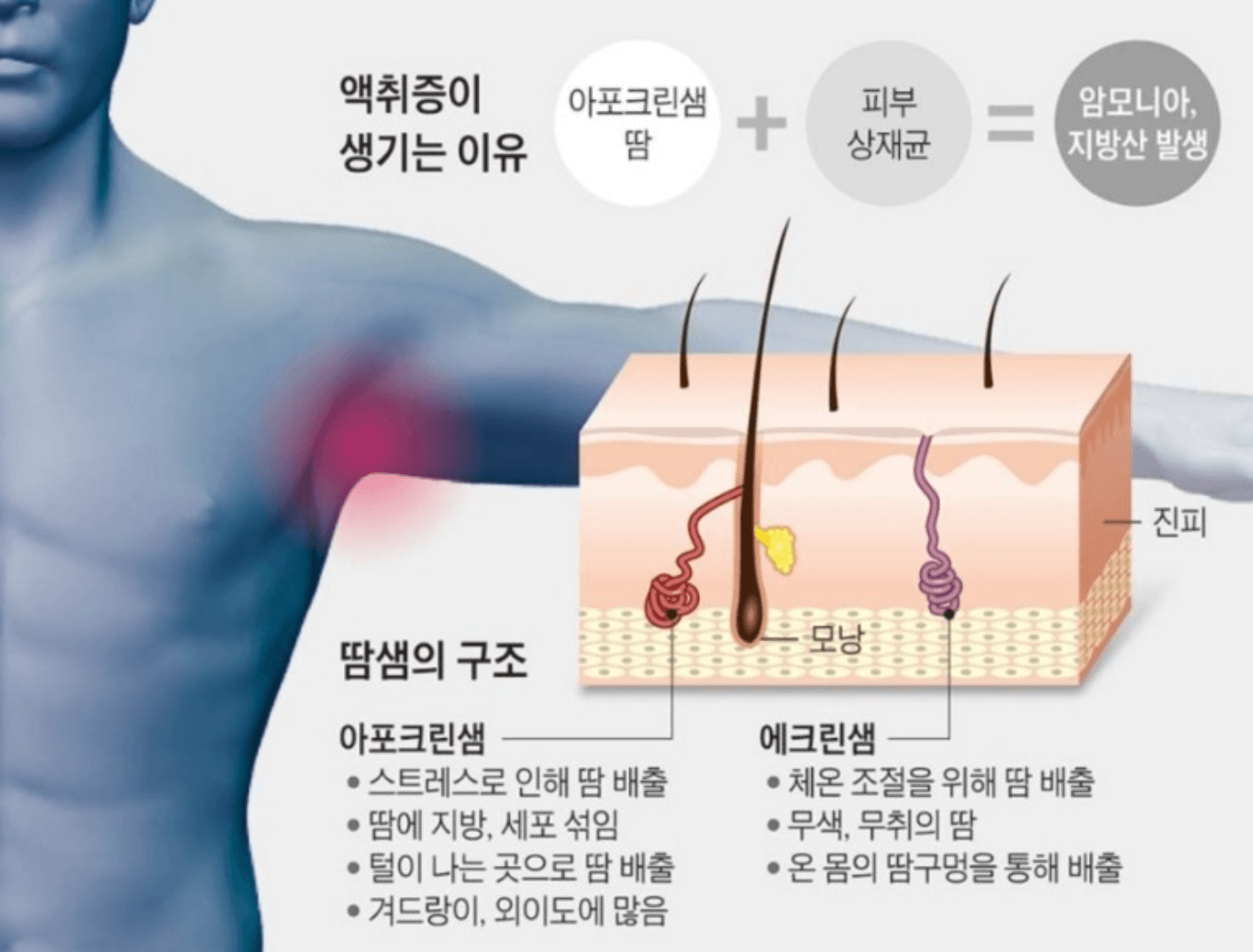 땀냄새의 원인 에포크린샘