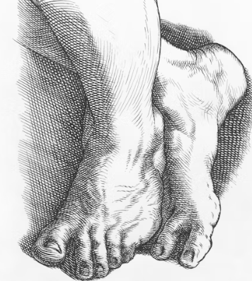 골다공증 검사 방법 증상 골절