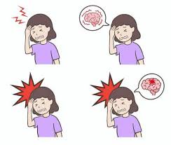 뇌졸증 전조 증상