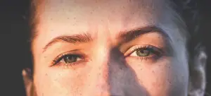 기미-생기는-원인-기미-사진