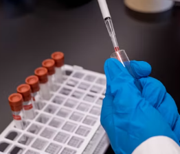 폐경기 호르몬 수치 해석 의미