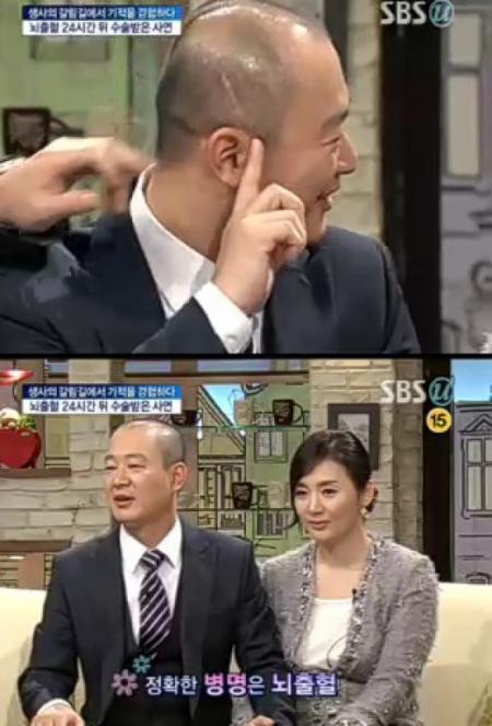 이진우 뇌출혈