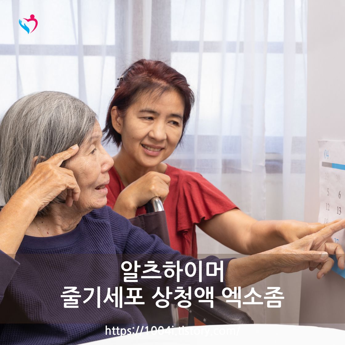 알츠하이머성 치매 뇌 신경 질환