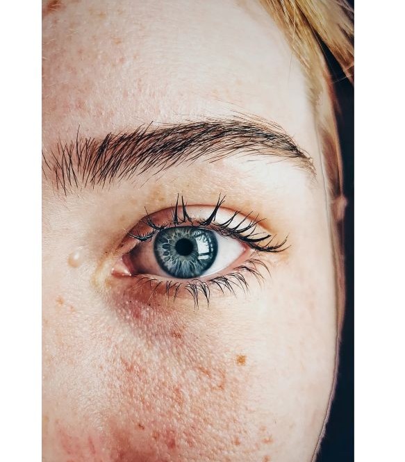 비판텐 연고 효능