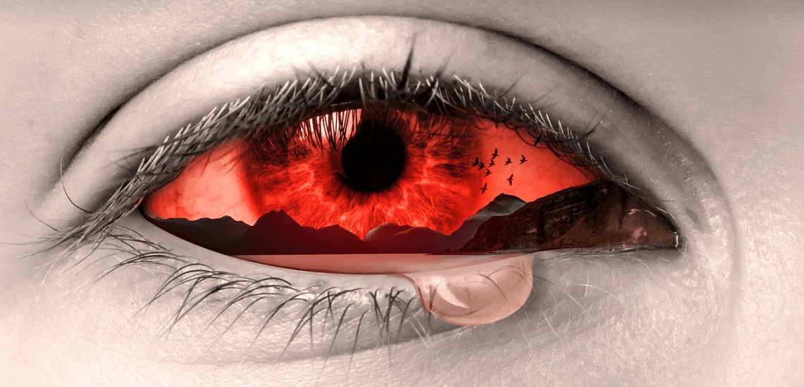 눈이 아픈 사람의 눈동자 사진 - 4