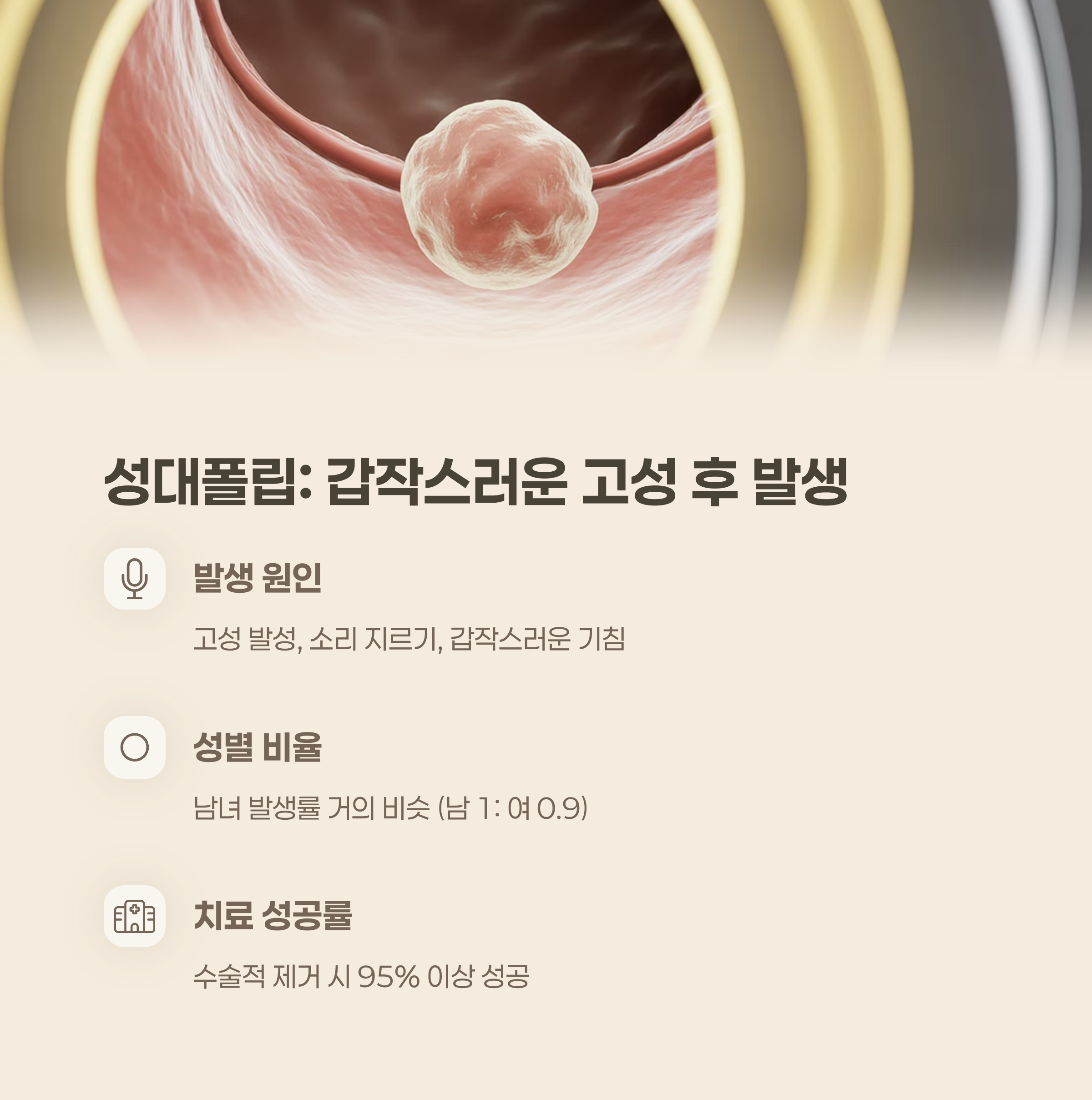 성대폴립: 갑작스러운 고성 사용 후 생기는 덩어리