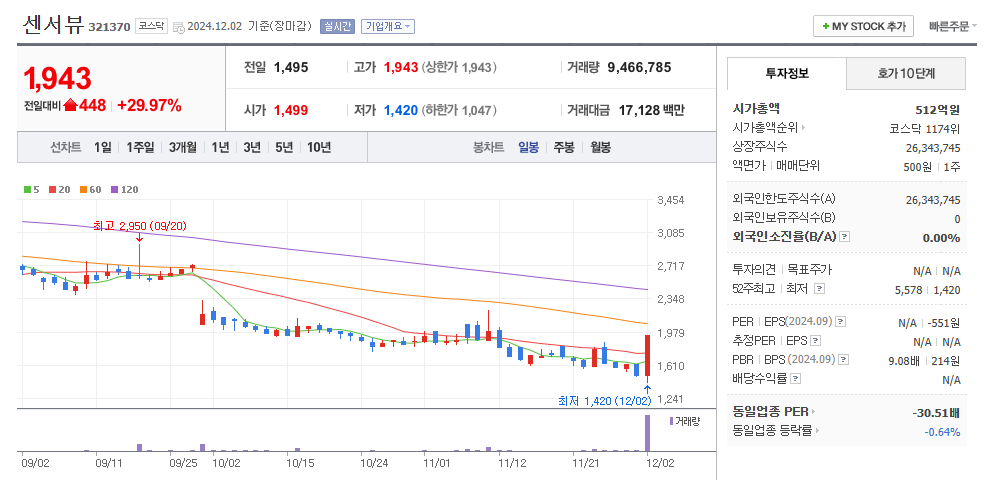 센서뷰 일봉차트