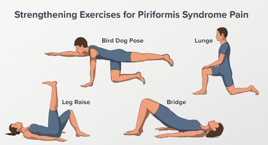 이상근 증후군 스트레칭