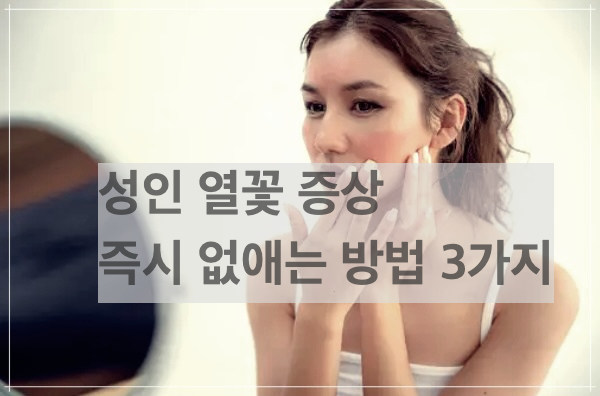 성인 열꽃 증상 즉시 없애는 방법 3가지