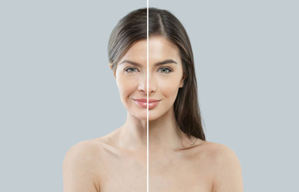 이마 보톡스 효과 언제부터 시기와 관리법 완벽 정리