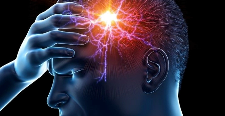 편두통 심할때 약