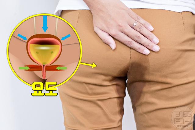 폐경 후 여성 질환 질병 요실금 요로감염