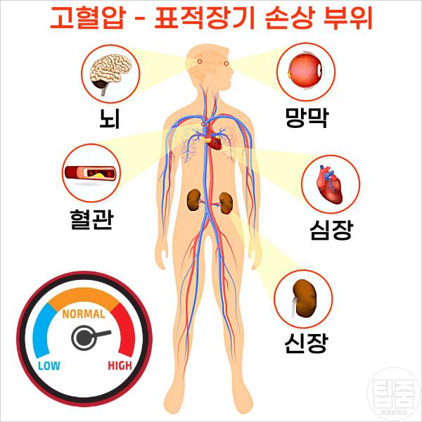 혈압 낮추는 영양제 고혈압영양제 추천