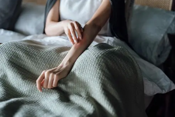 아나필락시스 쇼크