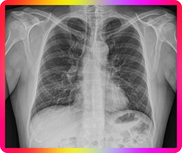 가래 관련 질환 종류