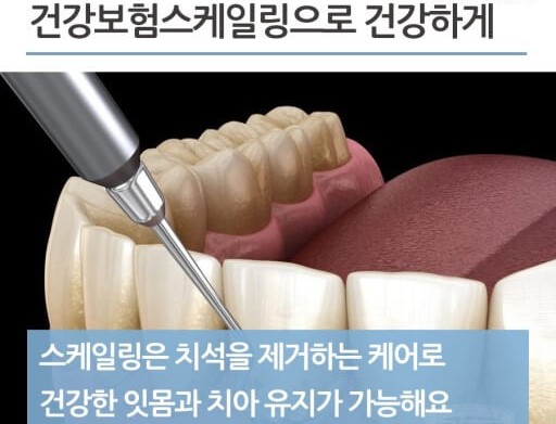 스케일링
