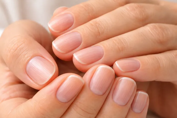 손톱에 세로줄이 생기는 이유