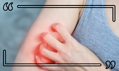 햇빛 알레르기 증상