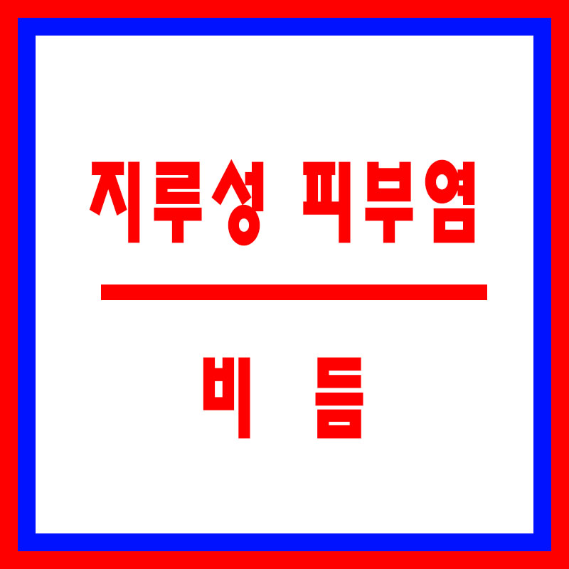 지루성피부염