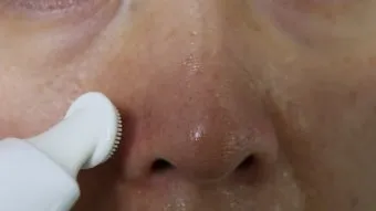 남자 얼굴 피지 제거 화장품 꿀템_28