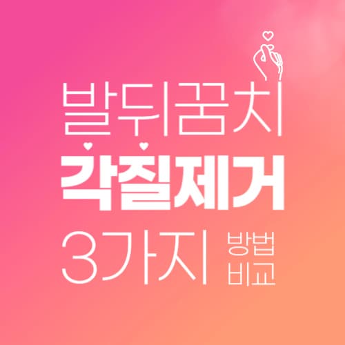 발뒤꿈치 각질 제거로 발 미인 되기- 대표적인 3가지 방법 비교