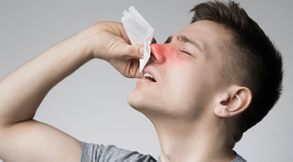 코피가 자주나는 이유 13