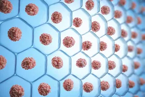 줄기세포-무릎수술