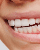 잇몸 염증 치료약