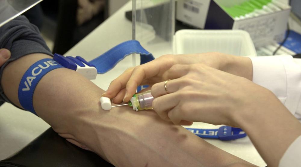 명의 갑상선호르몬 성장호르몬 쿠싱증후군 나잇살 고도비만 골다공증 호르몬 극복 치료법 내분비 내과 안철우 교수