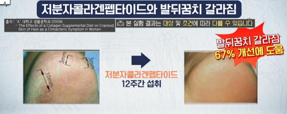 저분자 콜라겐 펩타이드 효능