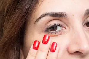 하안검수술-비용