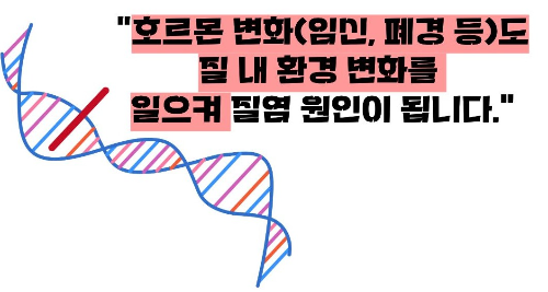 질염 증상 원인