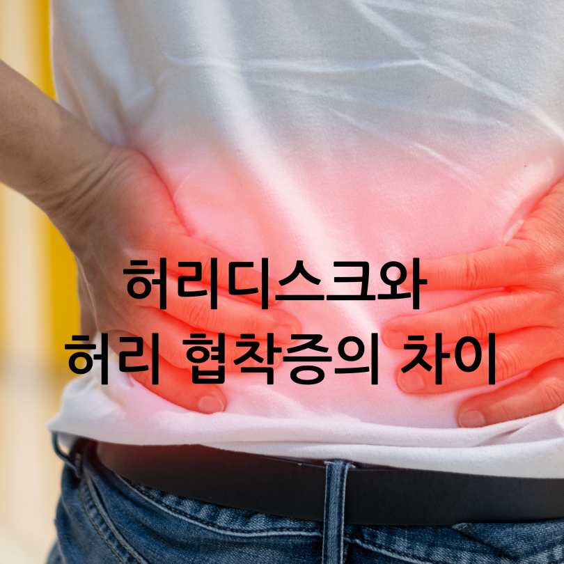 허리디스크와 허리 협착증의 차이점