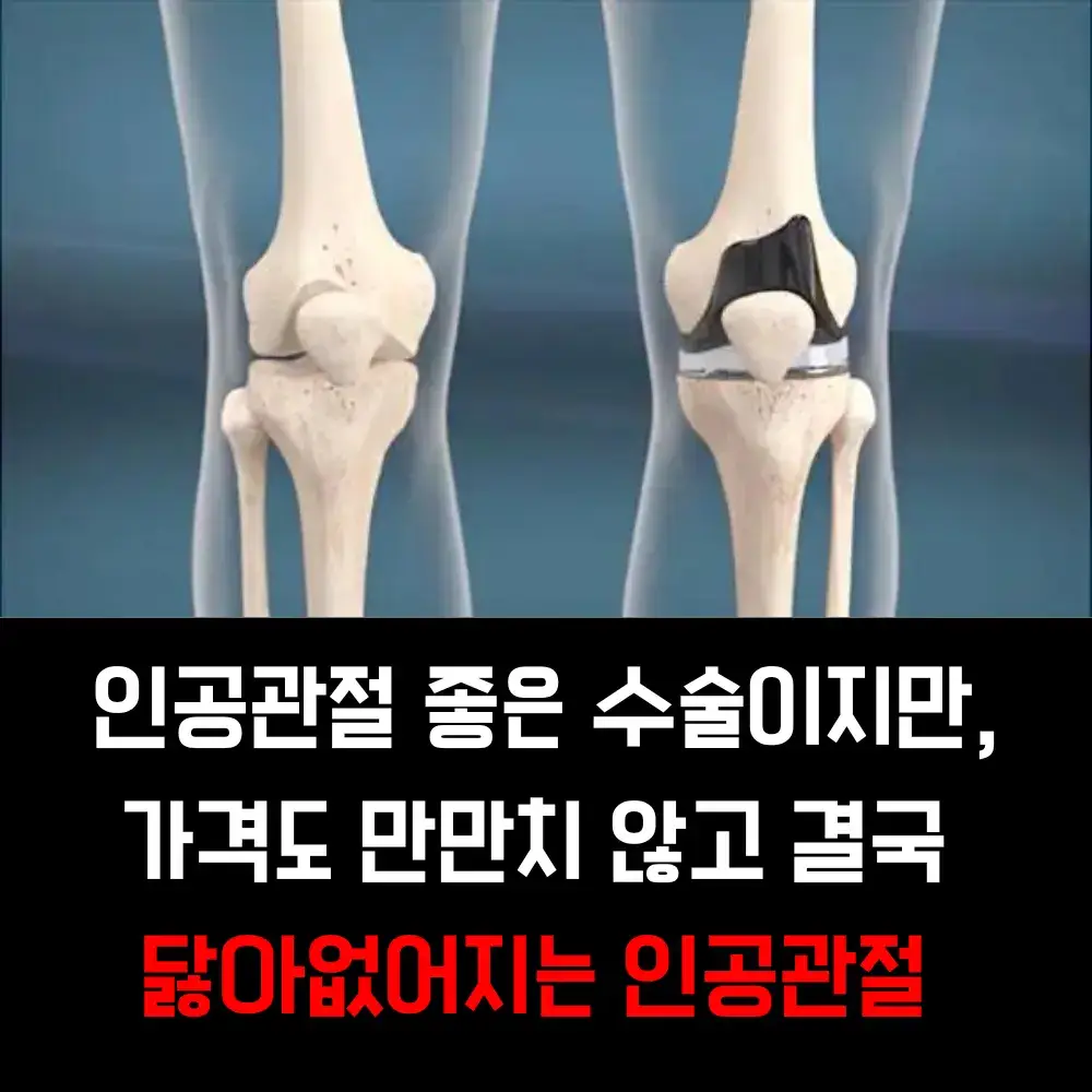 연골주사