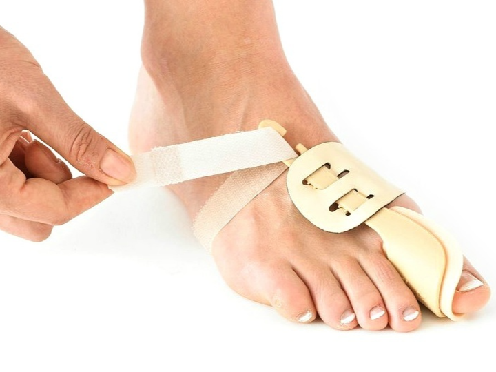발가락 골절의 종류와 발가락 골절 치료 방법