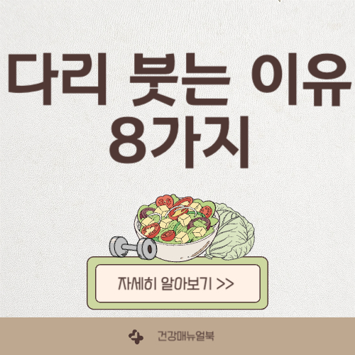 다리가 붓는 이유 원인